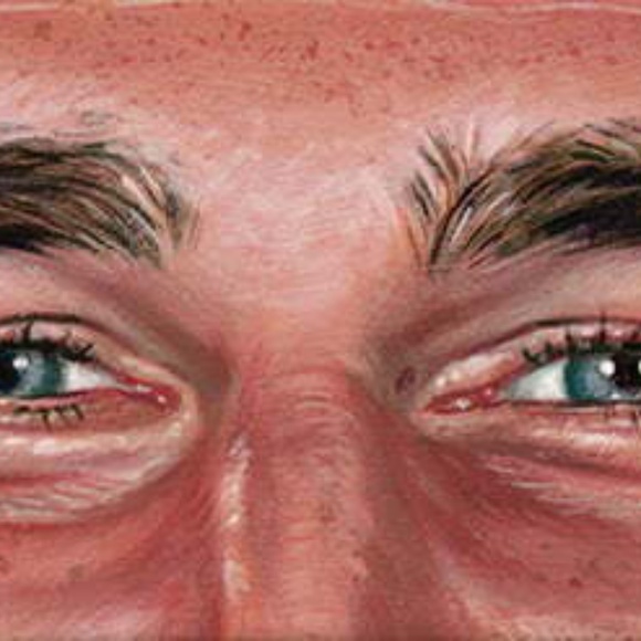 Jason Edmiston Taylor Swift & Travis Kelce GICLEÉ Print Set of 2 LE 200 - Picture 3 of 3